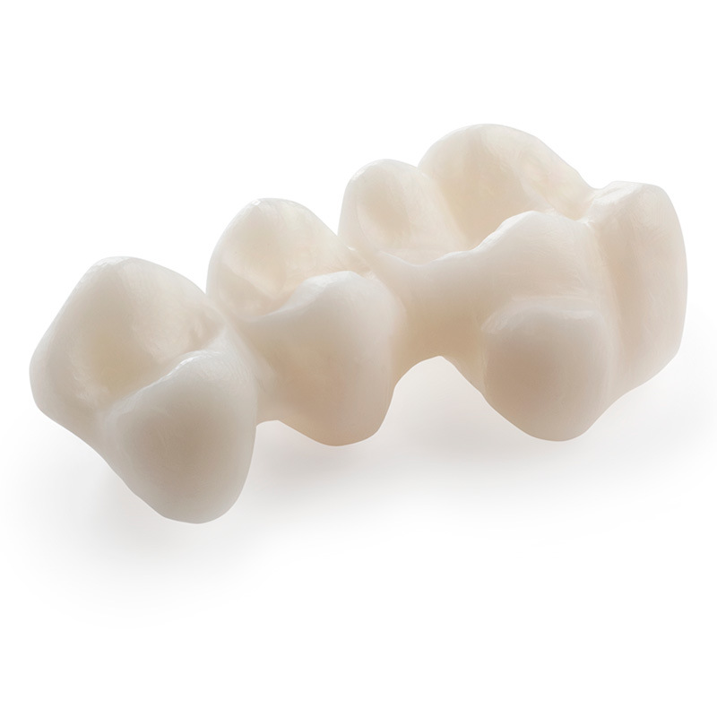 Implantatgetragenen Zähne sind ästhetisch ansprechend.