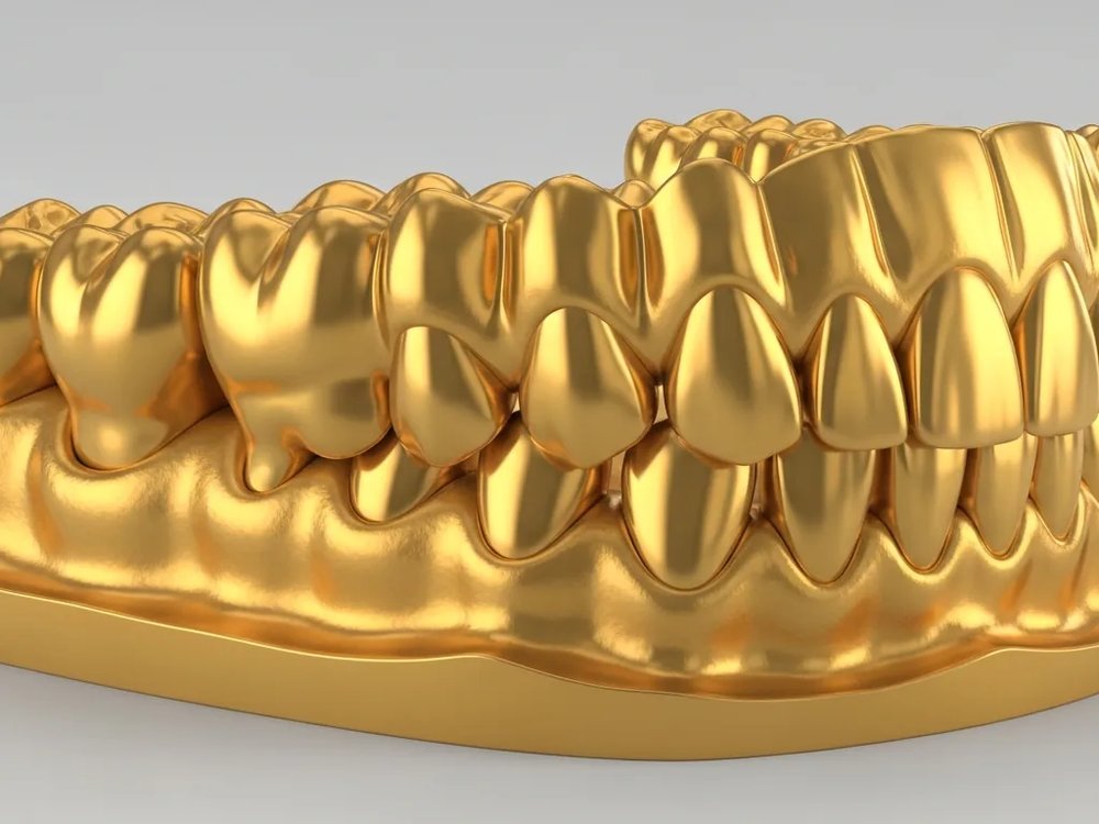 Digital dental model for computer-assisted manufacture