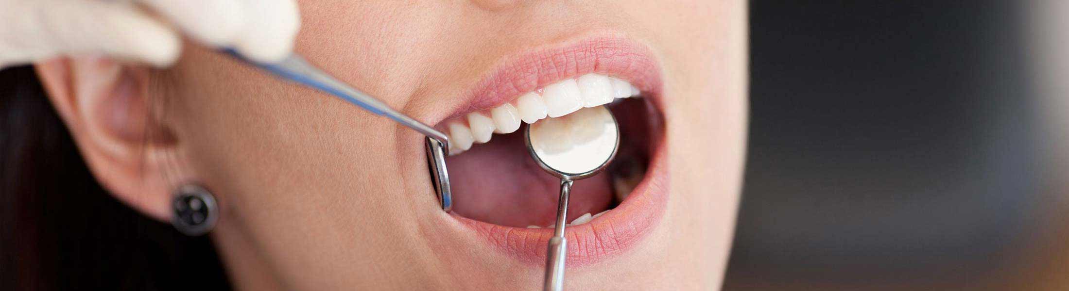 Kostenübernahme und Festzuschüsse bei Zahnimplantaten